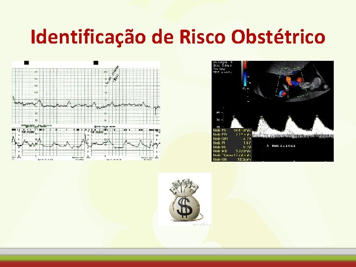 Identificação de Risco Obstétrico 