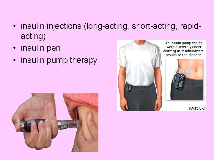  • insulin injections (long-acting, short-acting, rapidacting) • insulin pen • insulin pump therapy