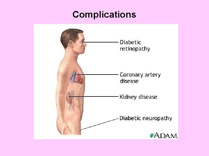 Complications 