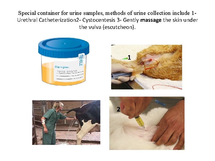 Special container for urine samples, methods of urine collection include 1 Urethral Catheterization 2