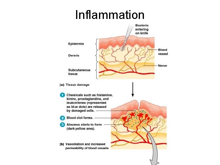 Inflammation 