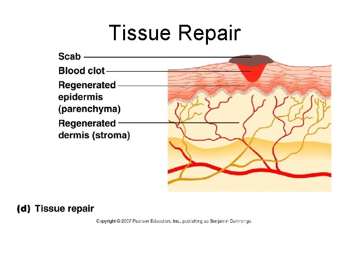 Tissue Repair 