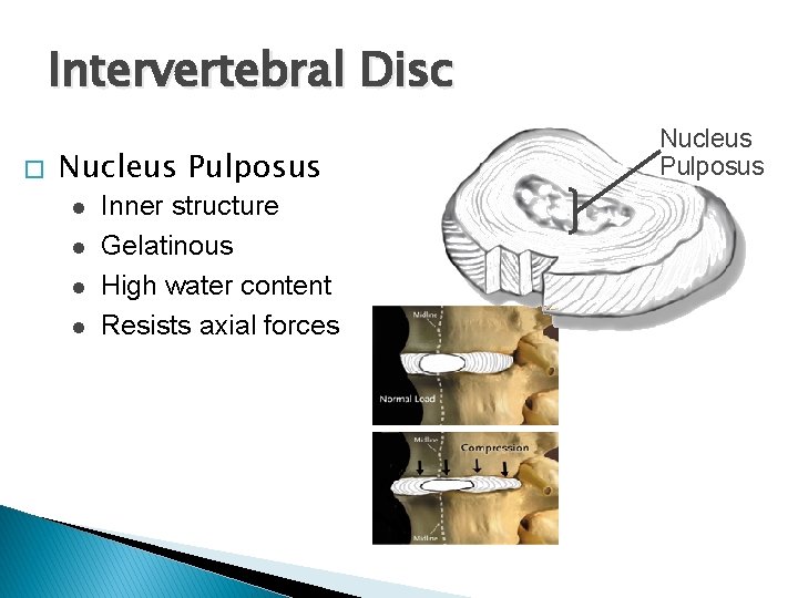 Intervertebral Disc � Nucleus Pulposus l l Inner structure Gelatinous High water content Resists Intervertebral Disc � Nucleus Pulposus l l Inner structure Gelatinous High water content Resists