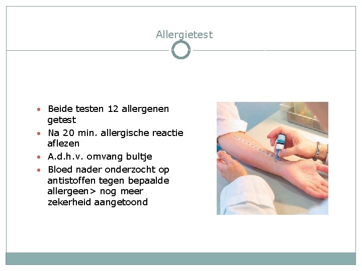 Allergietest • Beide testen 12 allergenen getest • Na 20 min. allergische reactie aflezen