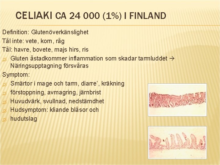 CELIAKI CA 24 000 (1%) I FINLAND Definition: Glutenöverkänslighet Tål inte: vete, korn, råg