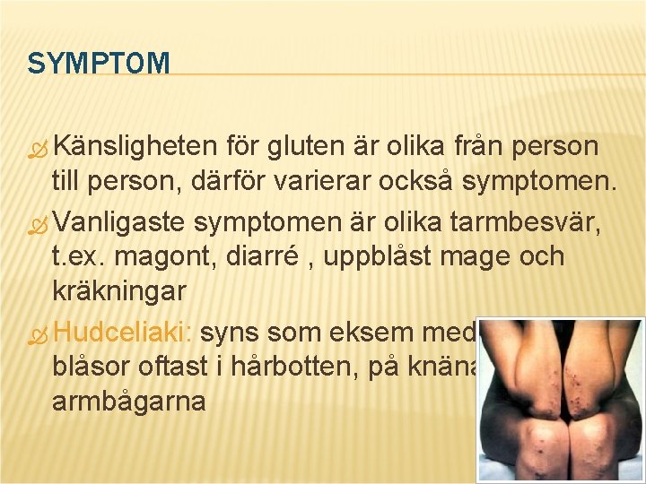 SYMPTOM Känsligheten för gluten är olika från person till person, därför varierar också symptomen.