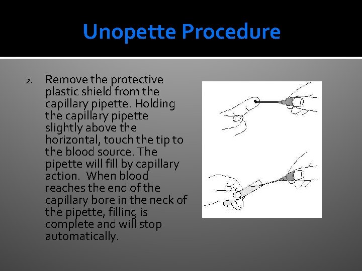 Unopette Procedure 2. Remove the protective plastic shield from the capillary pipette. Holding the