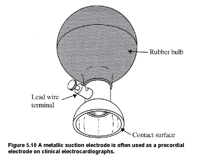 Figure 5. 10 A metallic suction electrode is often used as a precordial electrode