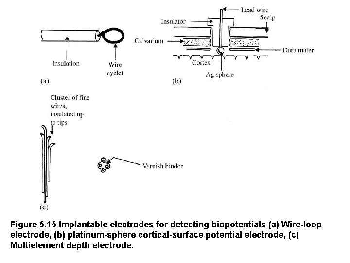 Figure 5. 15 Implantable electrodes for detecting biopotentials (a) Wire-loop electrode, (b) platinum-sphere cortical-surface