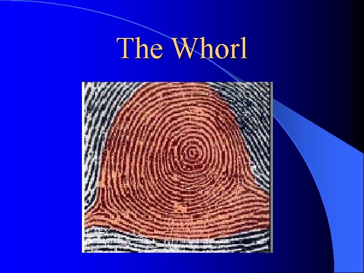 The Whorl 