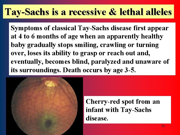 Tay-Sachs is a recessive & lethal alleles Symptoms of classical Tay-Sachs disease first appear