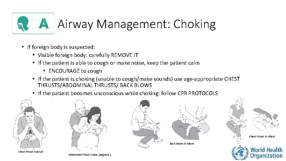 Airway Management: Choking • If foreign body is suspected: • Visible foreign body: carefully