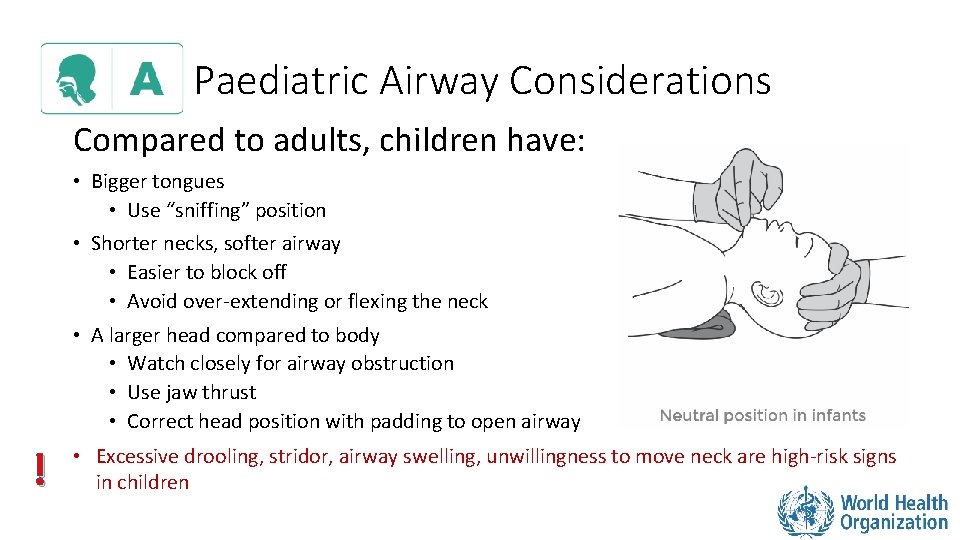 Paediatric Airway Considerations Compared to adults, children have: • Bigger tongues • Use “sniffing”