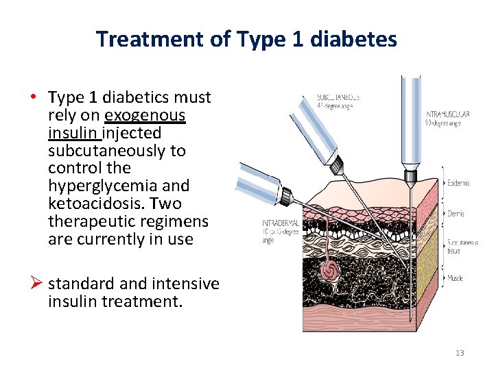 Treatment of Type 1 diabetes • Type 1 diabetics must rely on exogenous insulin