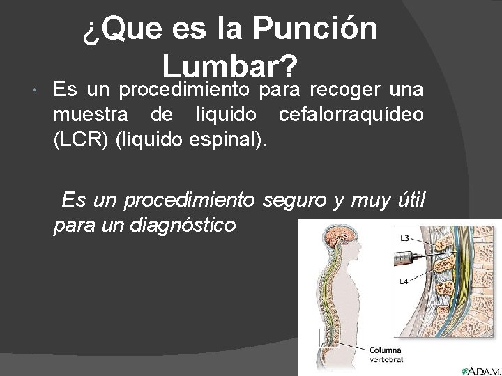  ¿Que es la Punción Lumbar? Es un procedimiento para recoger una muestra de