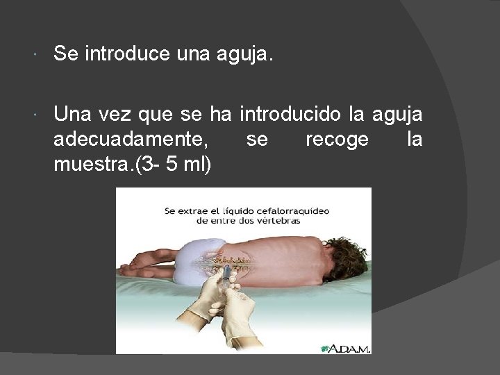  Se introduce una aguja. Una vez que se ha introducido la aguja adecuadamente,