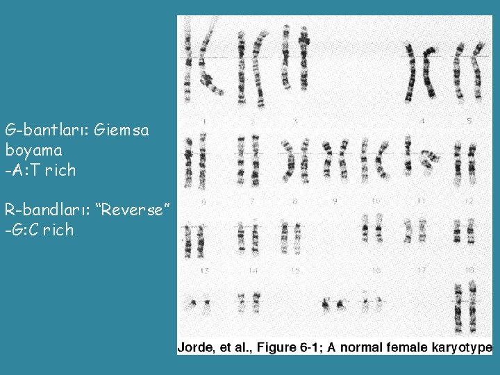 G-bantları: Giemsa boyama -A: T rich R-bandları: “Reverse” -G: C rich 