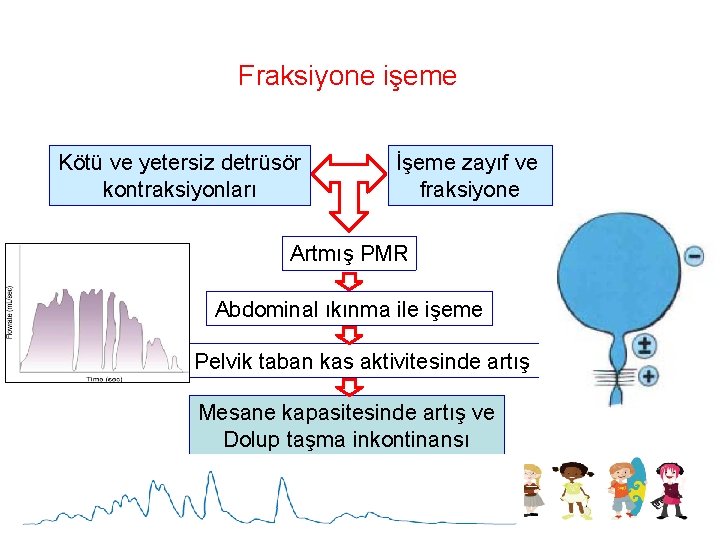 Fraksiyone işeme Kötü ve yetersiz detrüsör kontraksiyonları İşeme zayıf ve fraksiyone Artmış PMR Abdominal