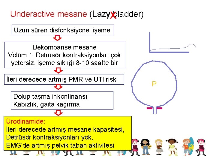 Underactive mesane (Lazyxbladder) Uzun süren disfonksiyonel işeme Dekompanse mesane Volüm ↑, Detrüsör kontraksiyonları çok
