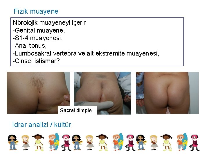 Fizik muayene Nörolojik muayeneyi içerir -Genital muayene, -S 1 -4 muayenesi, -Anal tonus, -Lumbosakral