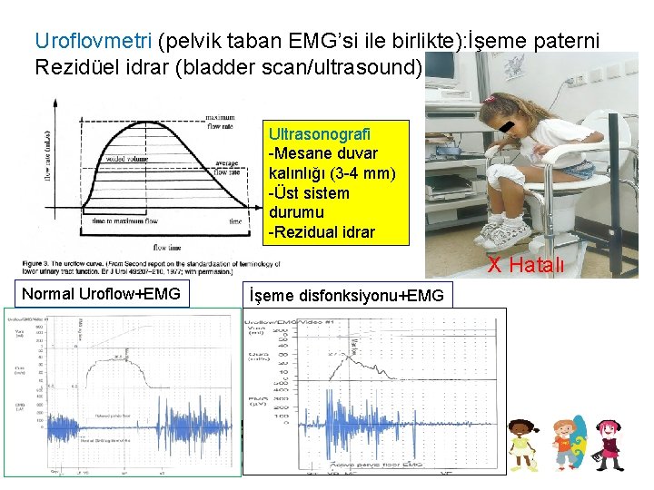 Uroflovmetri (pelvik taban EMG’si ile birlikte): İşeme paterni Rezidüel idrar (bladder scan/ultrasound) Ultrasonografi -Mesane