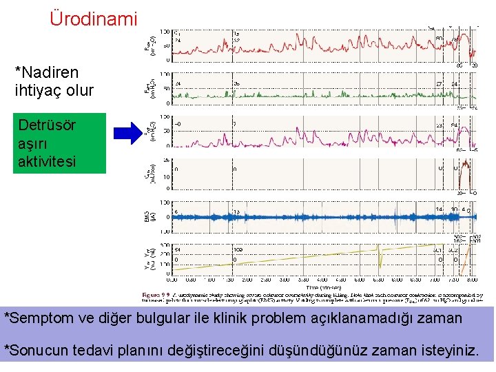 Ürodinami *Nadiren ihtiyaç olur Detrüsör aşırı aktivitesi *Semptom ve diğer bulgular ile klinik problem