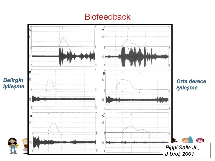 Biofeedback Belirgin iyileşme Orta derece iyileşme Pippi Salle JL, J Urol, 2001 