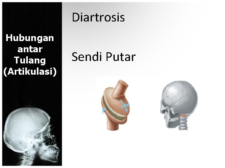 Diartrosis Hubungan antar Tulang (Artikulasi) Sendi Putar 