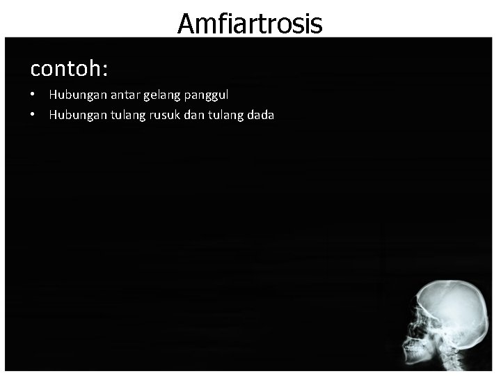 Amfiartrosis contoh: • Hubungan antar gelang panggul • Hubungan tulang rusuk dan tulang dada