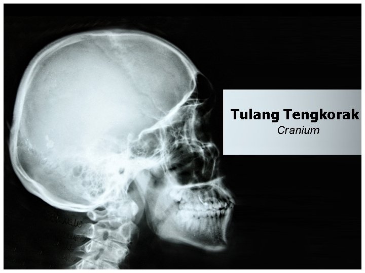 Tulang Tengkorak Cranium 