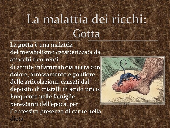 La malattia dei ricchi: Gotta La gotta è una malattia del metabolismo caratterizzata da