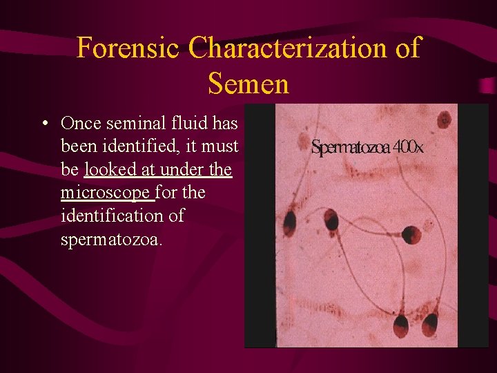 Forensic Characterization of Semen • Once seminal fluid has been identified, it must be