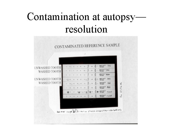 Contamination at autopsy— resolution 