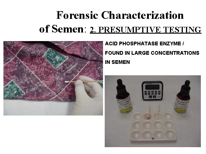 Forensic Characterization of Semen: 2. PRESUMPTIVE TESTING ACID PHOSPHATASE ENZYME / FOUND IN LARGE