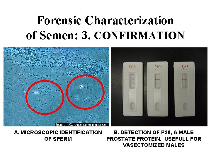 Forensic Characterization of Semen: 3. CONFIRMATION A. MICROSCOPIC IDENTIFICATION B. DETECTION OF P 30,