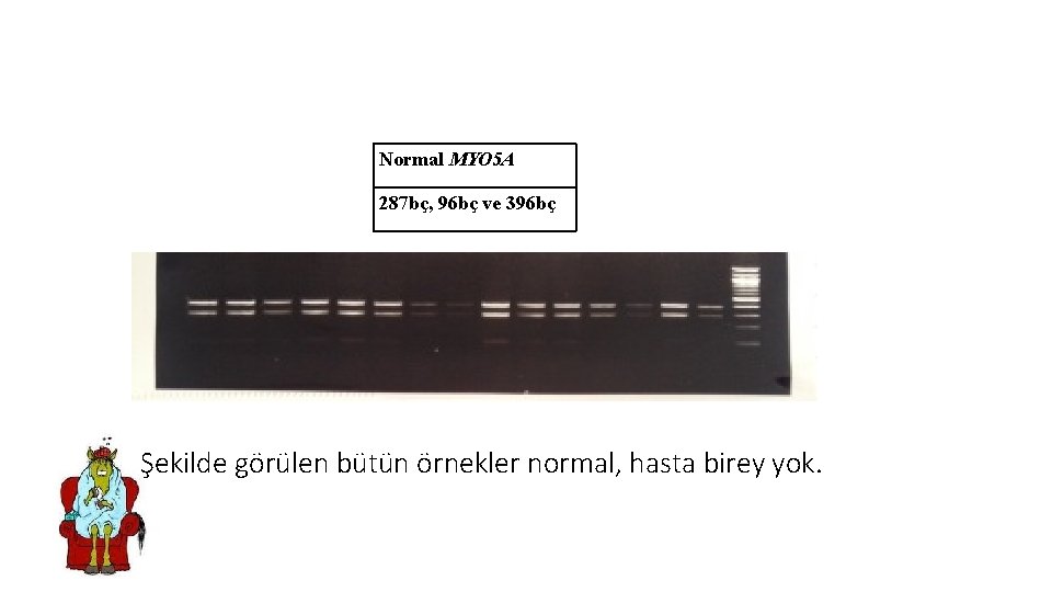 Normal MYO 5 A 287 bç, 96 bç ve 396 bç Şekilde görülen bütün