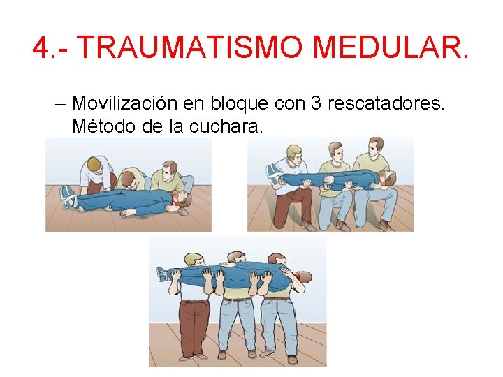 4. - TRAUMATISMO MEDULAR. – Movilización en bloque con 3 rescatadores. Método de la