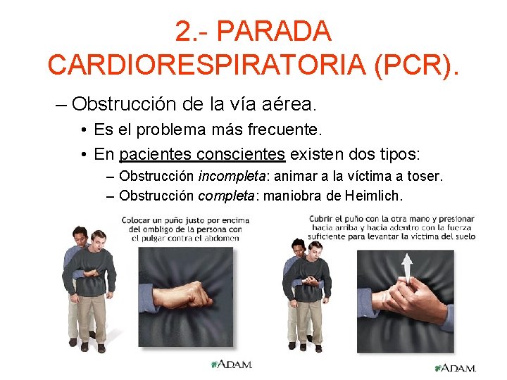 2. - PARADA CARDIORESPIRATORIA (PCR). – Obstrucción de la vía aérea. • Es el