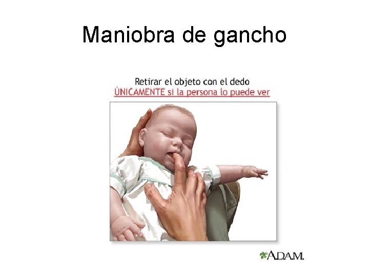 Maniobra de gancho 