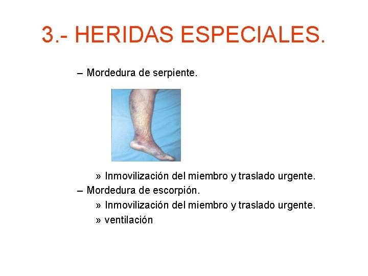 3. - HERIDAS ESPECIALES. – Mordedura de serpiente. » Inmovilización del miembro y traslado