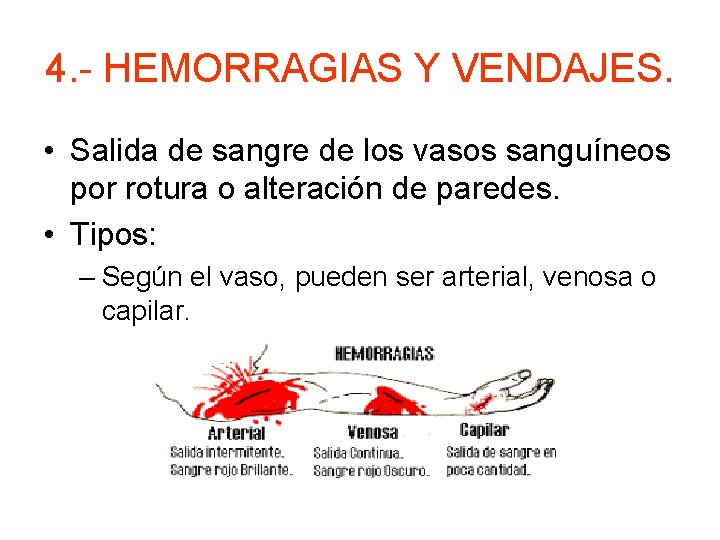 4. - HEMORRAGIAS Y VENDAJES. • Salida de sangre de los vasos sanguíneos por