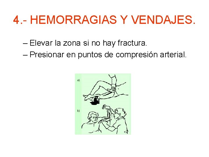 4. - HEMORRAGIAS Y VENDAJES. – Elevar la zona si no hay fractura. –