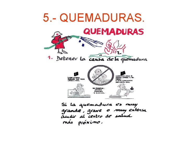 5. - QUEMADURAS. 