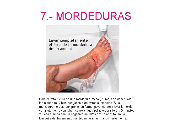 7. - MORDEDURAS 