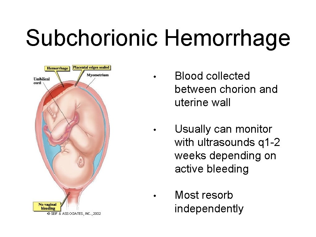 Subchorionic Hemorrhage • Blood collected between chorion and uterine wall • Usually can monitor