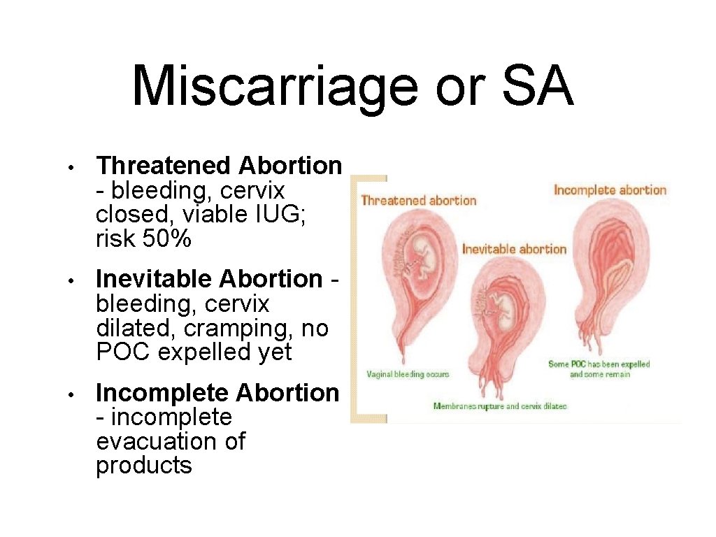 Miscarriage or SA • Threatened Abortion - bleeding, cervix closed, viable IUG; risk 50%