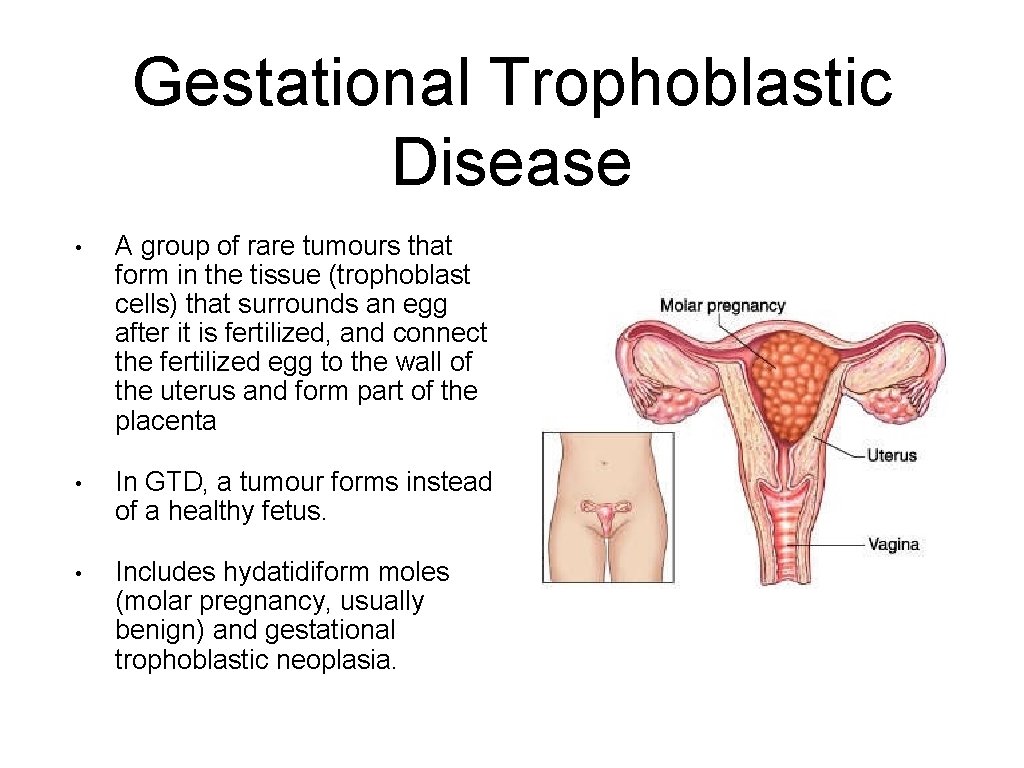 Gestational Trophoblastic Disease • A group of rare tumours that form in the tissue