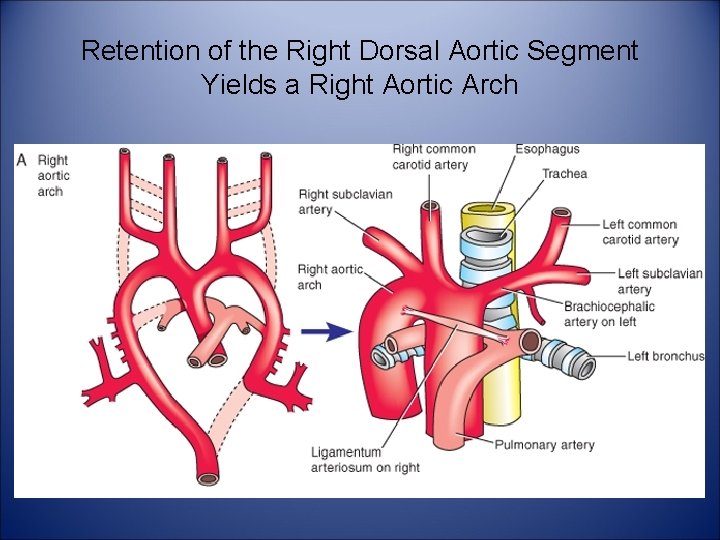 Retention of the Right Dorsal Aortic Segment Yields a Right Aortic Arch 