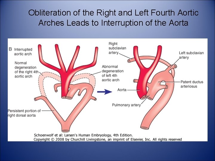 Obliteration of the Right and Left Fourth Aortic Arches Leads to Interruption of the