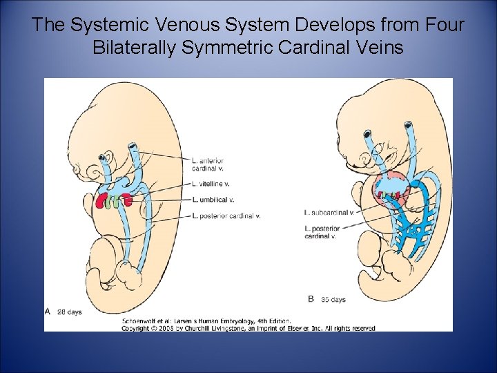 The Systemic Venous System Develops from Four Bilaterally Symmetric Cardinal Veins 